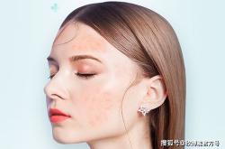 南通上门护肤,便捷美容新体验，在家享受专业呵护”
